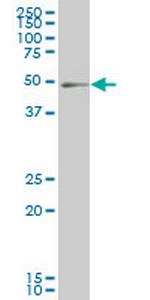 PKNOX1 Monoclonal Antibody (4H4)