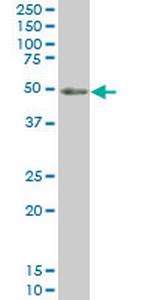 PKNOX1 Antibody in Western Blot (WB)