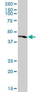 PKNOX1 Monoclonal Antibody (1F12)