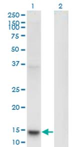 PLA2G1B Antibody in Western Blot (WB)
