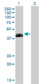 PLAUR Antibody in Western Blot (WB)