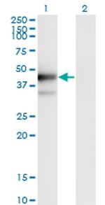 PLAUR Monoclonal Antibody (1D6)