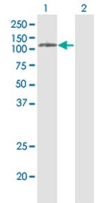 PLD2 Monoclonal Antibody (1C5)