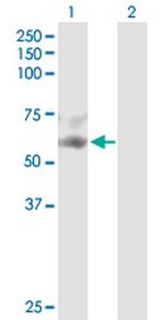 SERPINF2 Polyclonal Antibody, MaxPab™