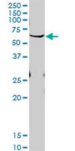 PLK1 Antibody in Western Blot (WB)