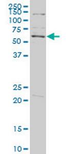 PLK1 Antibody in Western Blot (WB)