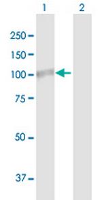 PLOD2 Polyclonal Antibody, MaxPab™