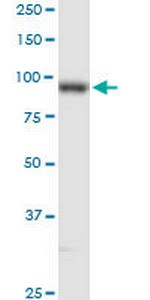 PLOD2 Polyclonal Antibody, MaxPab™