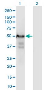 PLRG1 Monoclonal Antibody (7H2)