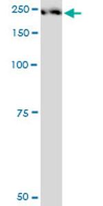 PLXNA2 Antibody in Western Blot (WB)