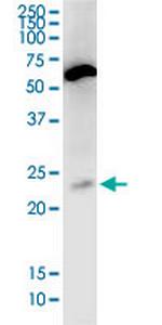 PNOC Monoclonal Antibody (4F6)