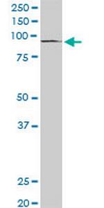PML Antibody in Western Blot (WB)