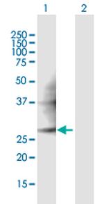 PMM2 Polyclonal Antibody, MaxPab™