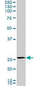 PMM2 Monoclonal Antibody (2A5)