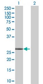 PNMT Polyclonal Antibody, MaxPab™