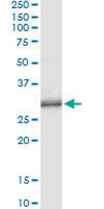PNMT Monoclonal Antibody (3G4)