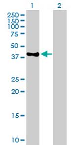 POLE Antibody in Western Blot (WB)