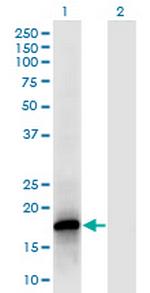 POLR2F Monoclonal Antibody (2G2)