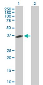 POMC Antibody in Western Blot (WB)