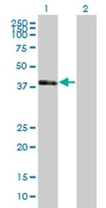 POU3F4 Polyclonal Antibody, MaxPab™