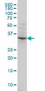 POU4F3 Monoclonal Antibody (5B8)