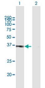 POU6F1 Antibody in Western Blot (WB)