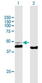 PPID Polyclonal Antibody, MaxPab™