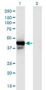 PPID Monoclonal Antibody (4C7)