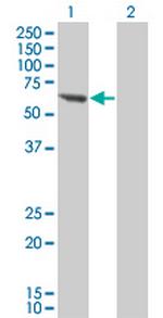 PPM1B Monoclonal Antibody (1A3-2A4)