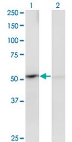 PPOX Antibody in Western Blot (WB)