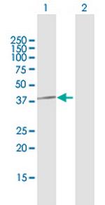 PPP1CC Polyclonal Antibody, MaxPab™