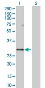 PPP1R2 Polyclonal Antibody, MaxPab™
