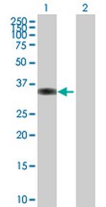 PPP1R3C Polyclonal Antibody, MaxPab™