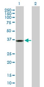 PPP1R3C Polyclonal Antibody, MaxPab™