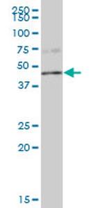 PPP1R7 Antibody in Western Blot (WB)
