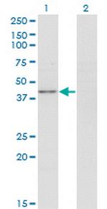 PPP1R8 Monoclonal Antibody (4B5)