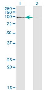 PPP1R10 Monoclonal Antibody (1D6)