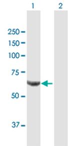 PPP2R1B Polyclonal Antibody, MaxPab™