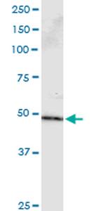 PPP2R2B Monoclonal Antibody (1B10)