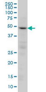 PPP2R2C Monoclonal Antibody (6D1)