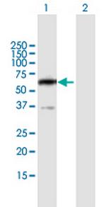 PPP2R5B Polyclonal Antibody, MaxPab™