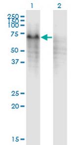 PPP2R5C Monoclonal Antibody (3G9)