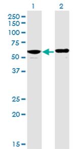 PPP2R5D Antibody in Western Blot (WB)