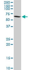 PPP2R5D Antibody in Western Blot (WB)