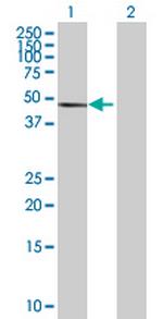 PPP2R5E Polyclonal Antibody, MaxPab™