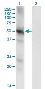 PPP3CC Monoclonal Antibody (4D1)