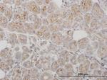 PPT1 Polyclonal Antibody, MaxPab™