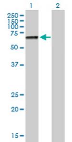 PRF1 Antibody in Western Blot (WB)
