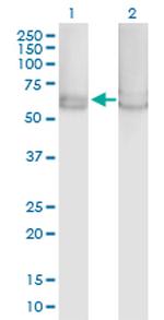 PRKAA1 Antibody in Western Blot (WB)