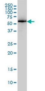 PRKAA1 Antibody in Western Blot (WB)